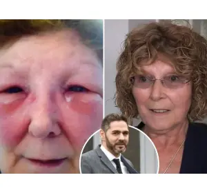 MARCELLE KING WHO FELL VICTIM TO BOGUS DOCTOR OZAN MELIN JOINS SAVE FACE AS PATIENT AMBASSADOR